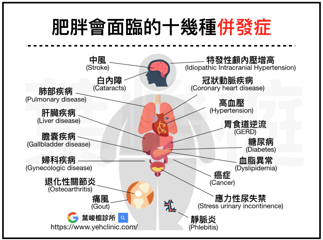 肥胖治療