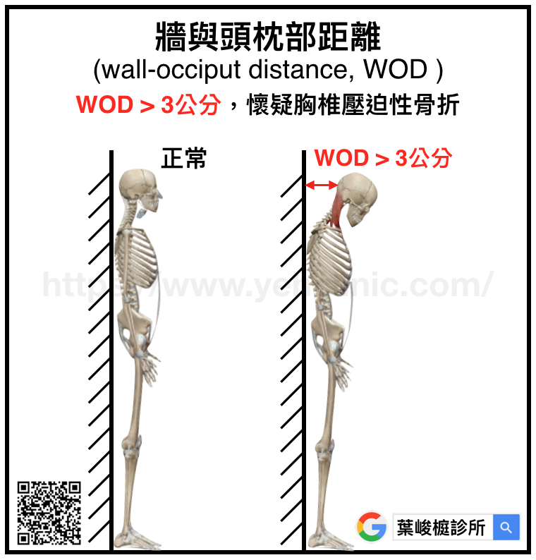骨質疏鬆